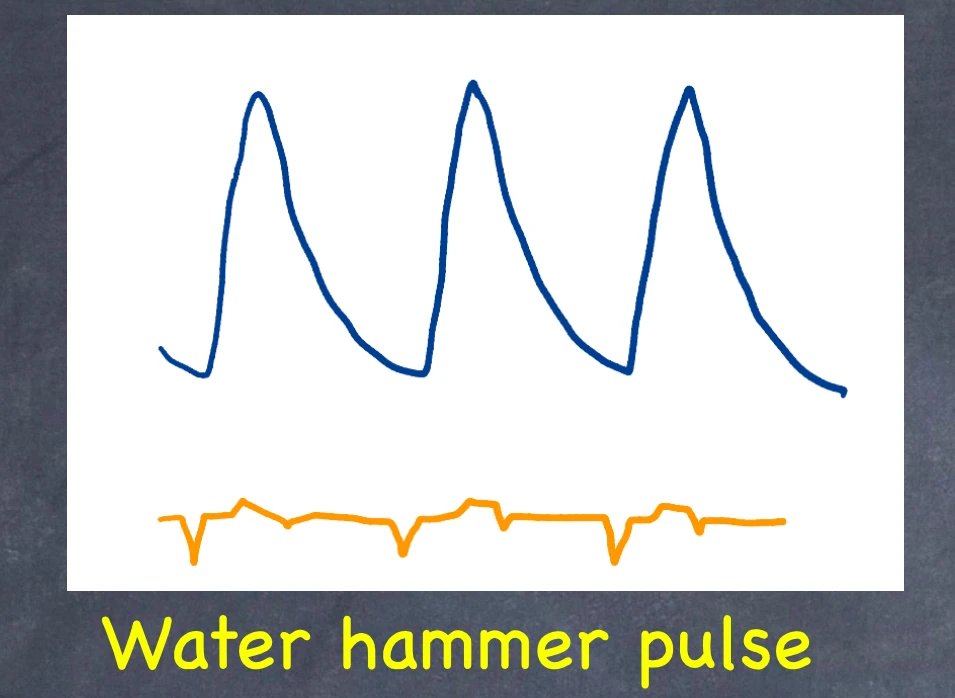 Water-hammer-pulse