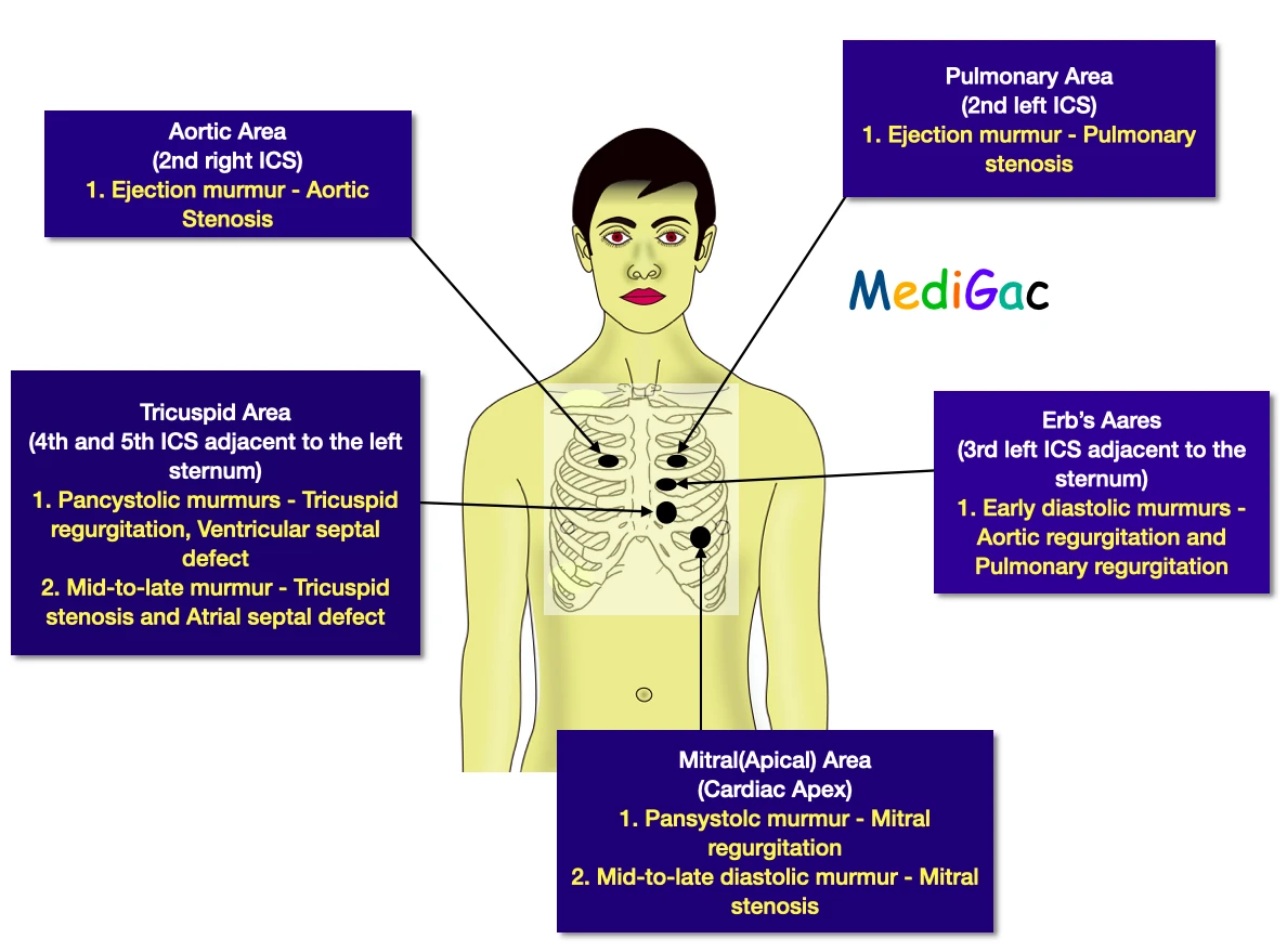 Cardiac Murmurs : Definition, Mechanisms, Grades, Types, Loudness – MediGac