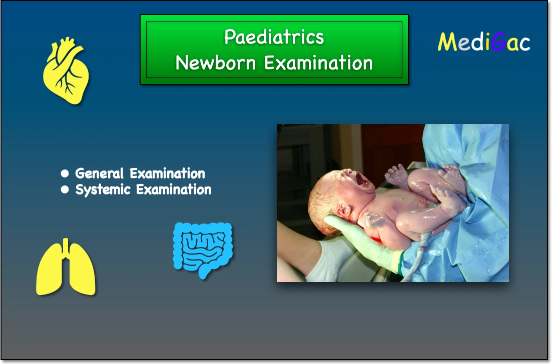 Newborn-baby-examination