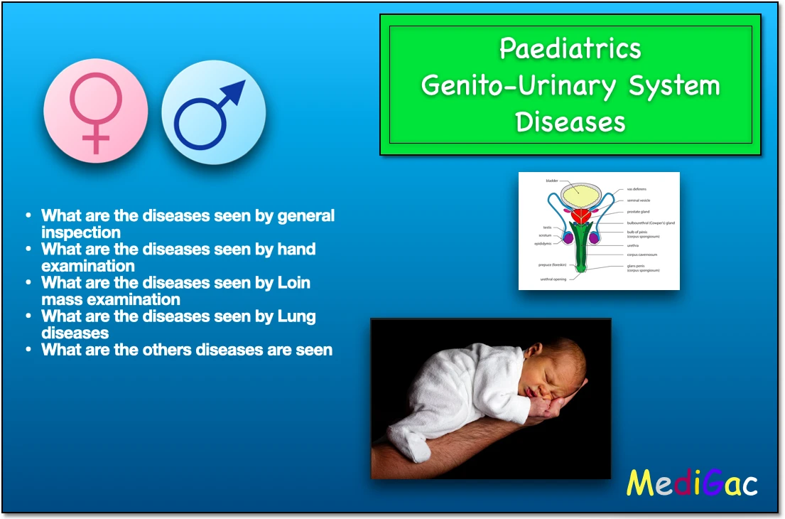 Paediatrcis-genital-urinary-system-diseases