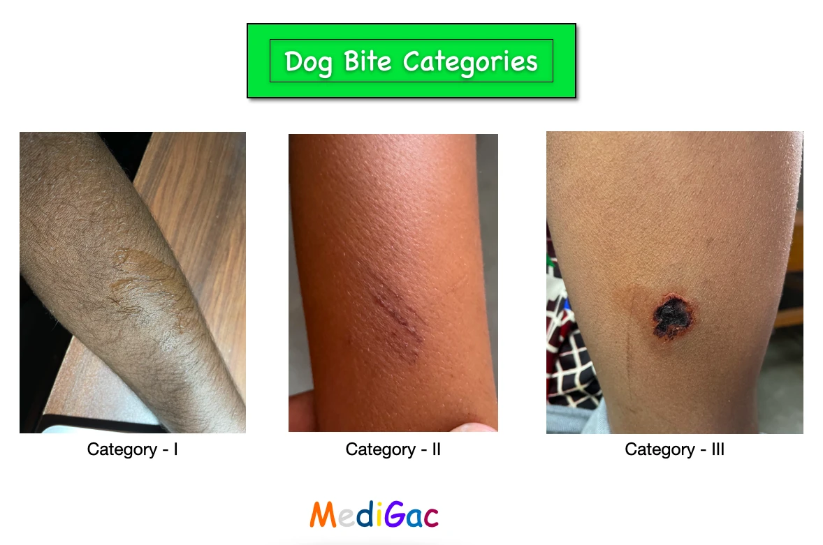 Dog Cat Bite – Category And Management With Images – Medigac